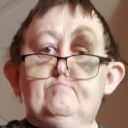 My 3rd Anniversary Of Near Death!